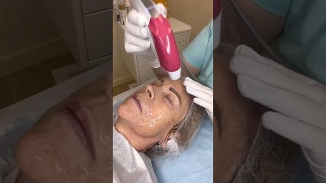 SMAS лифтинг области вокруг глаз смотреть онлайн