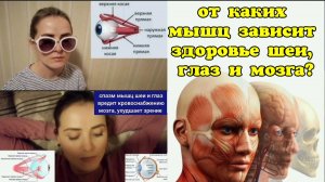 Шея и глаза "трещат" от напряжения? Снимите спазм задних прямых мышц головы и нижних косых мышц
