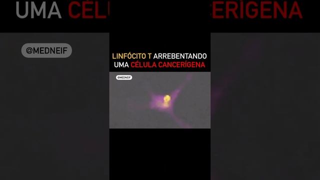 Ação de um linfócito na destruição de uma célula tumoral. смотреть онлайн