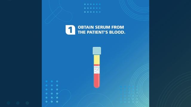 Behind Duke-NUS Medical School's SARS-CoV-2 Serology Test смотреть онлайн