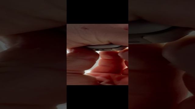 08-11-2024 Нокиа