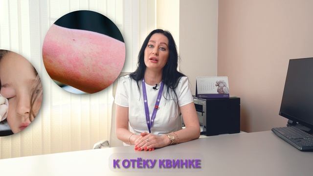 Толерантность к аллергенам смотреть онлайн