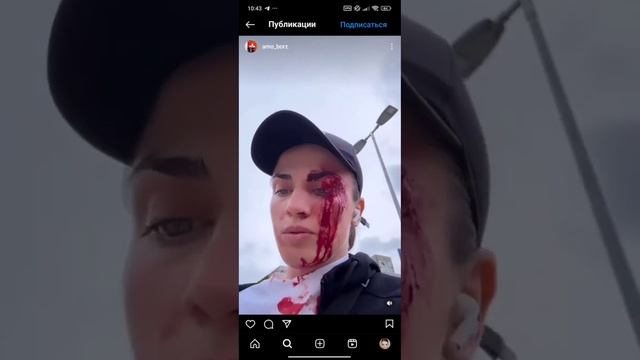 В Швейцарии избили спортсменку чеченского происхождения смотреть онлайн