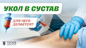 Уколы в сустав - безопасно ли?. На сколько больно и зачем их делать? Гиалуроновая кислота.