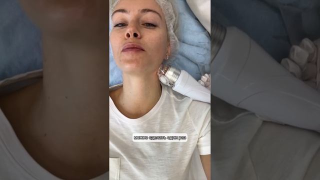 Игольчатый RF-лифтинг лица смотреть онлайн