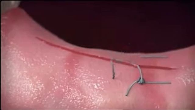 Suturing technique Техника наложения швов Tikuv Usullari смотреть онлайн