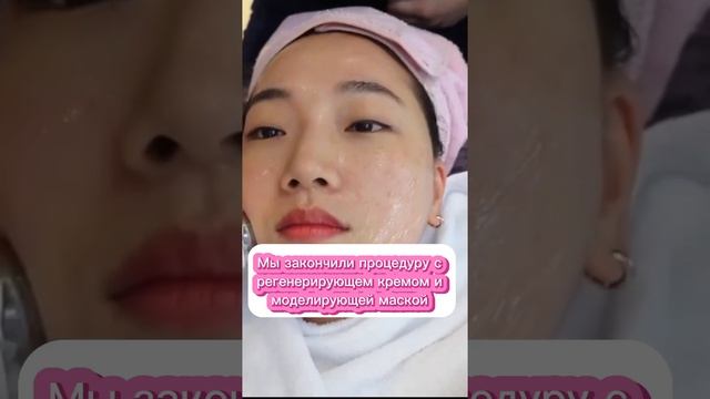 Лазер Excel V смотреть онлайн