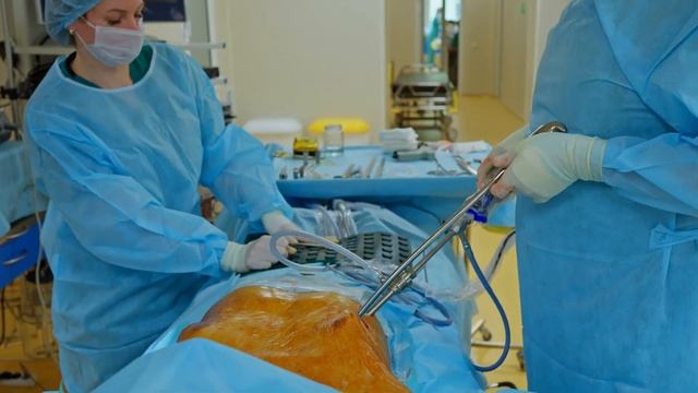 Операция Насса у мужчины 29 лет из города Красноярск с широким плоским типом ВДГК смотреть онлайн