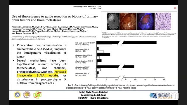 Diskusi Ilmiah Neuro-Onkologi смотреть онлайн