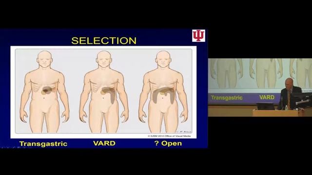 Evolving Treatment of Necrotizing Pancreatitis - Nicholas J. Zyromski - MD смотреть онлайн