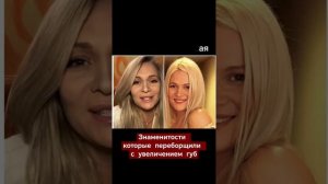 ⭐Потеряли свою индивидуальность из-за увеличения губ