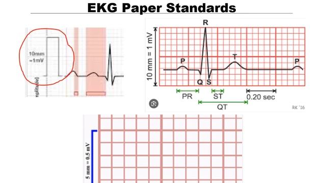 Optimum Academy Heart 101 Video 4 High Blood Pressure & Left Ventricular Hypertrophy смотреть онлайн
