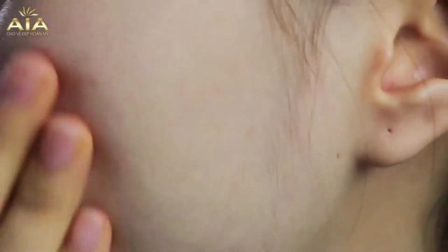 Serum trị nám giá bình dân Ance Melasma AIA Cosmetic hàng chính hãng смотреть онлайн