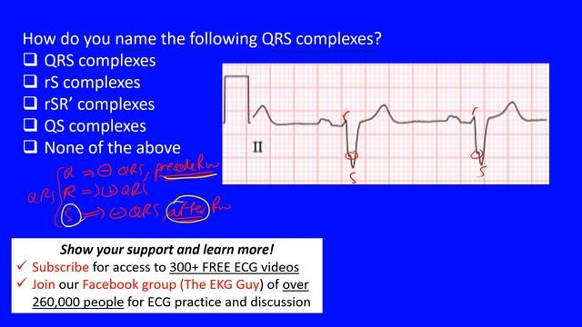 EKG/ECG QRS Complex Nomenclature - Question 5.0 | The EKG Guy смотреть онлайн