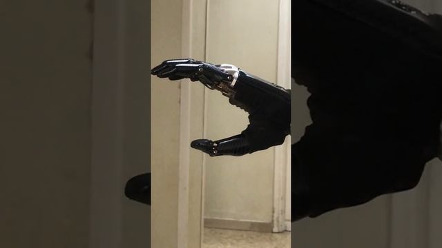 Protesi di mano bionica смотреть онлайн