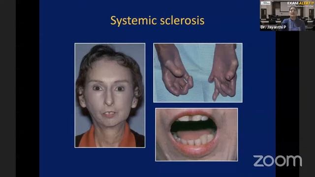 Exam Alert - Oral Pathology смотреть онлайн