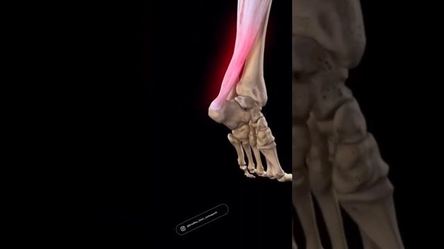 ACHILLES Rupture #muscle #tendons #bones #movement #physiotherapy #anatomy #study #viral #shortsfee смотреть онлайн