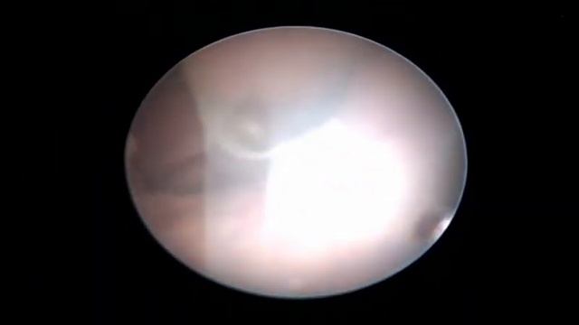 septotomy смотреть онлайн
