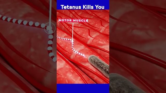 Tetanus kills you #germs #bacteria смотреть онлайн
