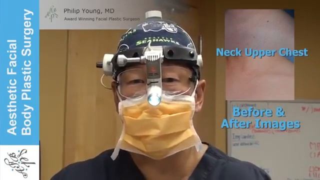 Live Laser Mole Removal. See Dr Young Vaporize a Mole with this Live Demo. Learn About Mole Removal смотреть онлайн