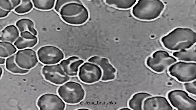 Один стакан воды в день - достаточно ли этого для здоровья организма? смотреть онлайн