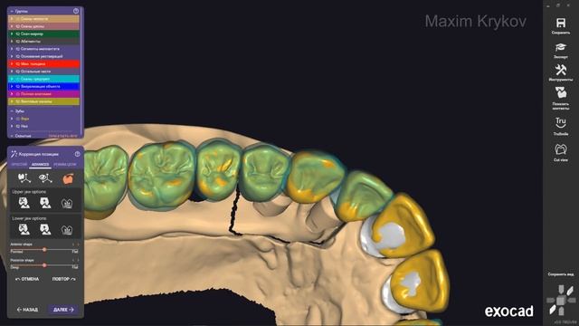 Exocad Big Project Part 1 I Tooth Modeling 24 смотреть онлайн
