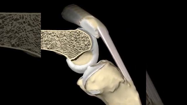 Biomecânica da patela смотреть онлайн