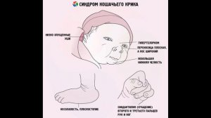 Синдром Кошачий крик