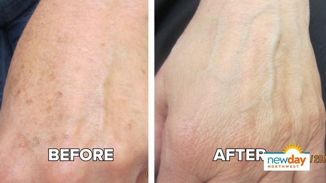 How to reverse the signs of aging using green tea botanicals - New Day NW смотреть онлайн