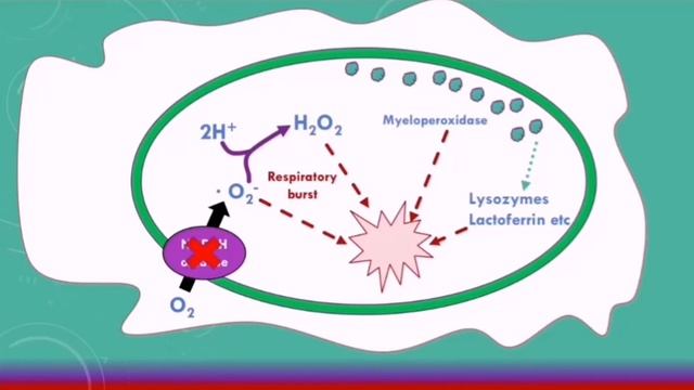 Chronic Granulomatous Disease - Medical Tutorial смотреть онлайн