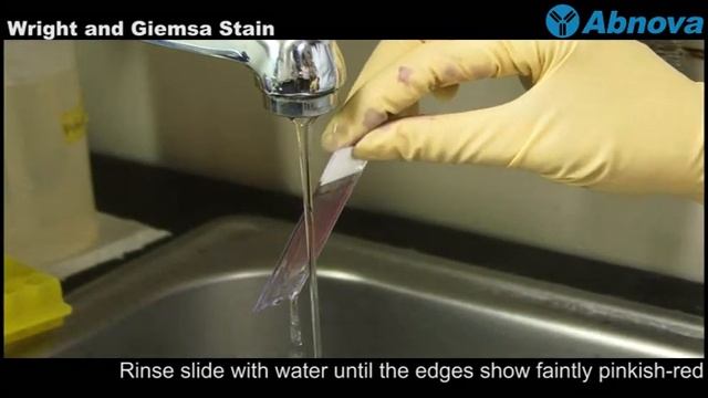 Wright and Giemsa Stain смотреть онлайн