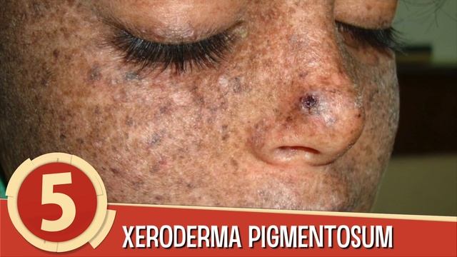 10 MOST HORRIFYING AND RAREST DISORDERS EVER смотреть онлайн