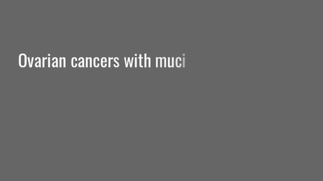 Which histology ovarian cancer has the lowest incidence of elevated CA 125? смотреть онлайн
