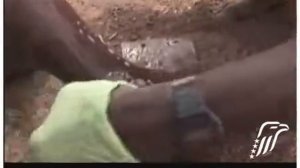 Паразиты. Искоренение дракункулеза Укрощение «огненного змея» Центр Картера Eradicating Guinea Worm