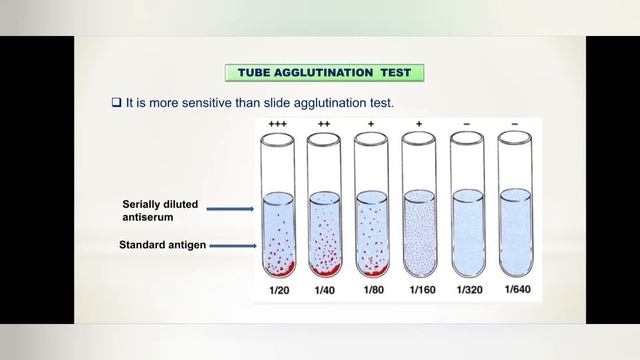 Agglutination reaction| Slide test| Tube test| Passive agglutination test смотреть онлайн