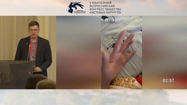 Гордиенко И.И.: хирургическое лечение околовнутрисуставных переломов фаланг пальцев кисти у детей.