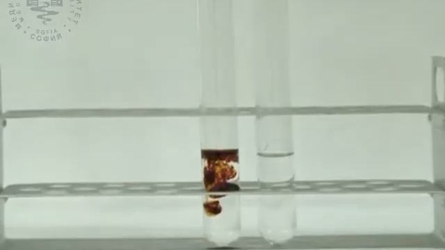 07 Determination of Acid Phosphatase in Blood Serum смотреть онлайн