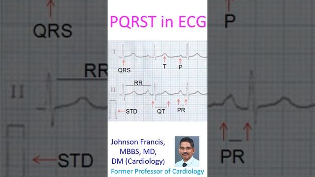 PQRST in ECG смотреть онлайн