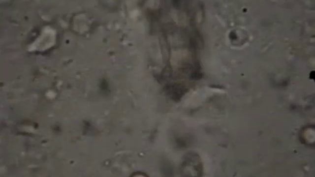 Frotis directo de heces diarreicas con trofozoito de Giardia de un perro смотреть онлайн