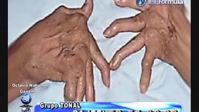 Salud Integral- Padecimientos Ortopédicos Y De Las Articulaciones  1/4