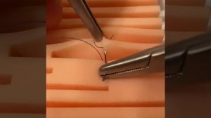8-образный шов Спасокукоцкого \ 8-shaped seam of Spasokukotsky