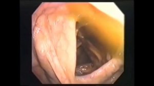 Как сухое голодание может изменить вашу жизнь?