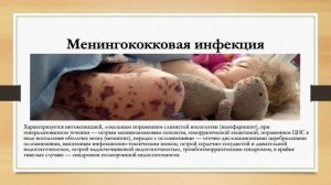 ДЕТСКИЕ ИНФЕКЦИИ