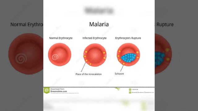 ##💫MALARIA DISEASES ##💫ANIMATION VIDEO 💫💫💫💫💥💥💥##curious knowledge diversity смотреть онлайн