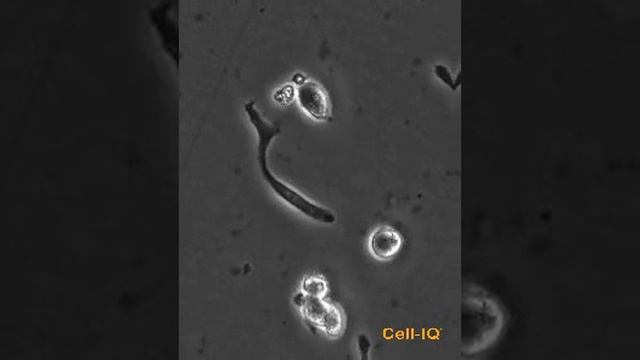 Macrophage eating смотреть онлайн