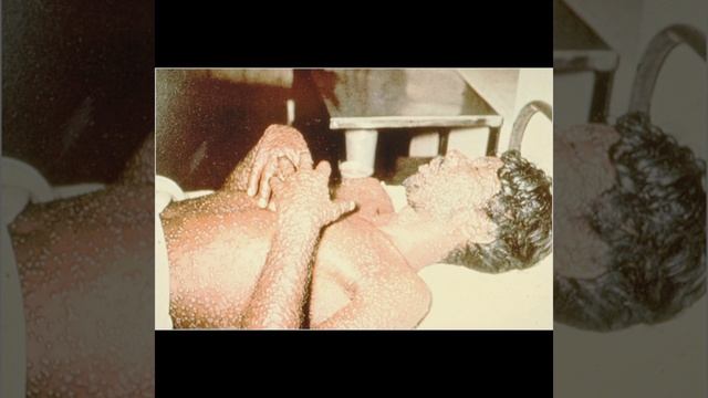 diseases because of them most of the people died #shortvideo #viral #trending 😭😭 смотреть онлайн