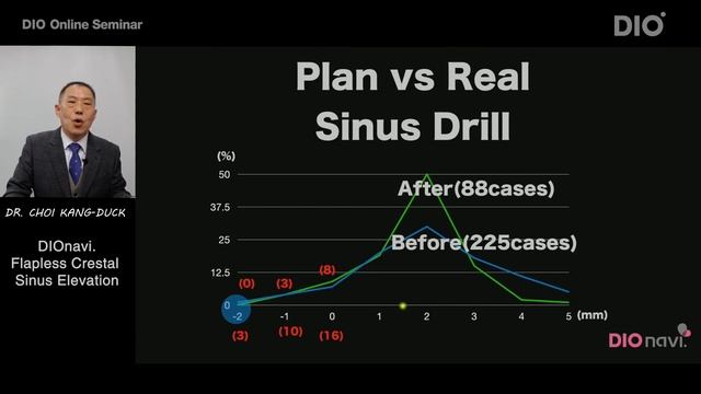 Flapless Crestal Sinus Elevation by Dr. Choi Kangduck смотреть онлайн