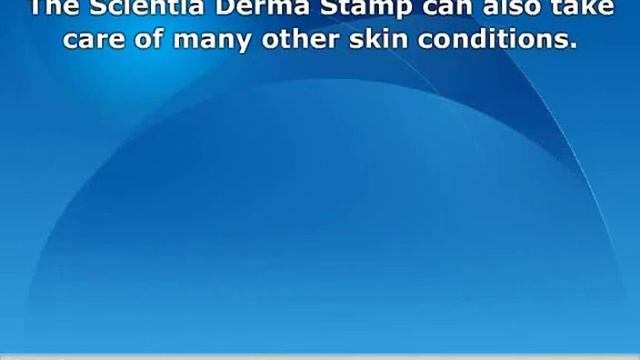 Derma Stamp for Acne Scarring смотреть онлайн