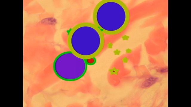 IMMUNE SYSTEM: T HELPER CELLS смотреть онлайн
