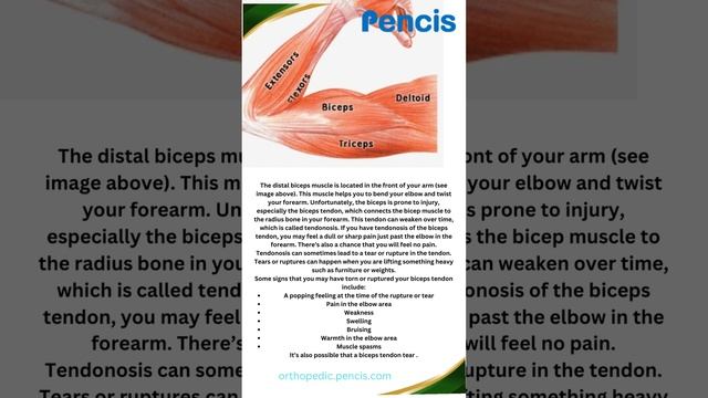 The distal biceps muscle is located in the front of your arm . смотреть онлайн